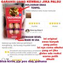 Garansi/Cara Menghilangkan Tato / Tattoo dengan Tattonox Obat Penghilang Tatto Permanen