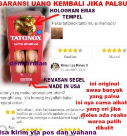 Garansi/Cara Menghilangkan Tato / Tattoo dengan Tattonox Obat Penghilang Tatto Permanen